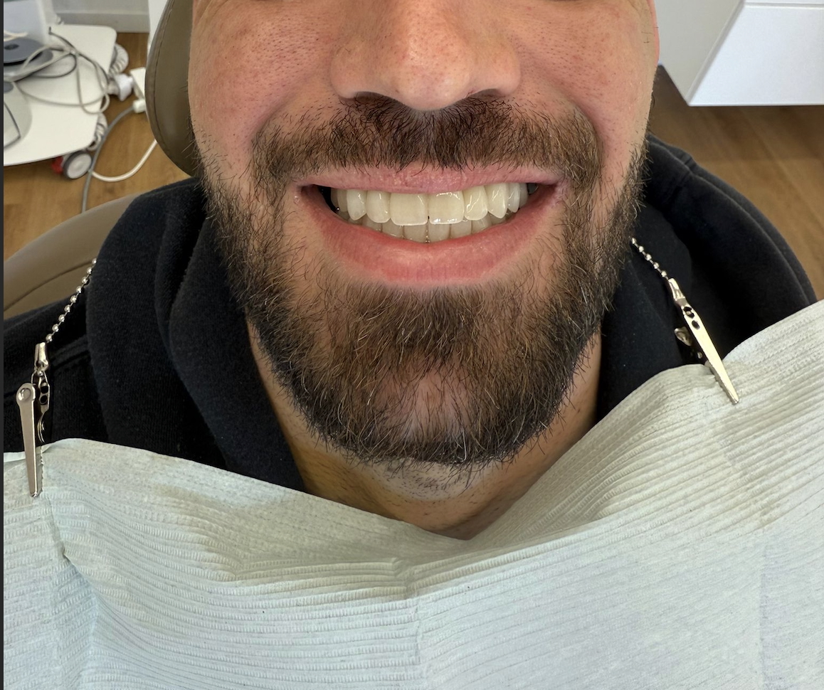 Fall 1 — nach der Behandlung
